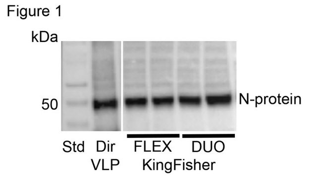 Dynabeads SARS-CoV-2 Spike, 製品情報