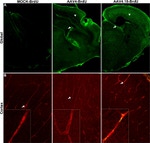 BrdU Antibody in Immunohistochemistry (IHC)