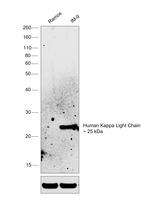 Human Kappa Light Chain Secondary Antibody in Western Blot (WB)