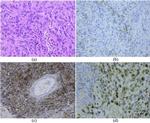 MDM2 Antibody in Immunohistochemistry (IHC)