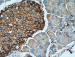 Marcks Antibody in Immunohistochemistry (Paraffin) (IHC (P))