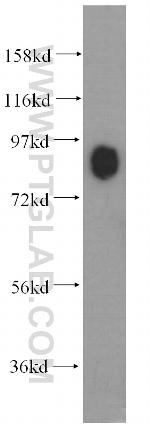 Marcks Antibody in Western Blot (WB)