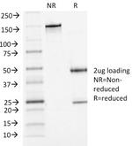 P-Cadherin (CDH3) Antibody in SDS-PAGE (SDS-PAGE)