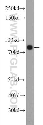 5 Lipoxygenase Antibody in Western Blot (WB)