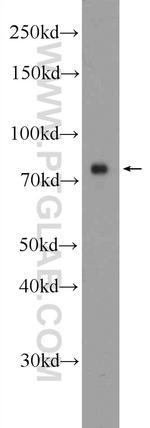 5 Lipoxygenase Antibody in Western Blot (WB)