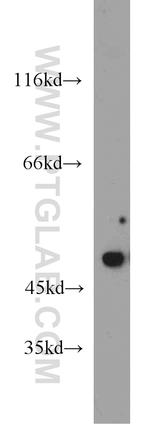 XIAP Antibody in Western Blot (WB)