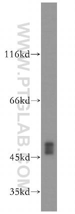 XIAP Antibody in Western Blot (WB)