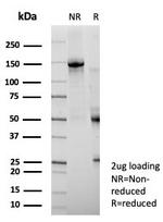 Occludin (OCLN) (Tight Junctions Marker) Antibody in SDS-PAGE (SDS-PAGE)