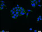 beta Tubulin Antibody in Immunocytochemistry (ICC/IF)