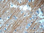 beta Tubulin Antibody in Immunohistochemistry (Paraffin) (IHC (P))