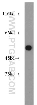 beta Tubulin Antibody in Western Blot (WB)