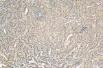 UBC9 Antibody in Immunohistochemistry (Paraffin) (IHC (P))