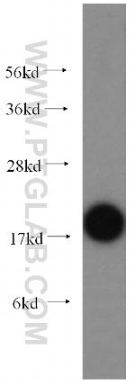 UBC9 Antibody in Western Blot (WB)