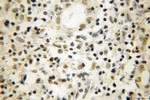 NOB1 Antibody in Immunohistochemistry (Paraffin) (IHC (P))