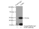 NOB1 Antibody in Immunoprecipitation (IP)