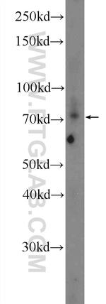 AKAP8L Antibody in Western Blot (WB)