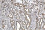 PRC1 Antibody in Immunohistochemistry (Paraffin) (IHC (P))