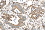 PRC1 Antibody in Immunohistochemistry (Paraffin) (IHC (P))