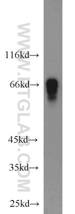 PRC1 Antibody in Western Blot (WB)