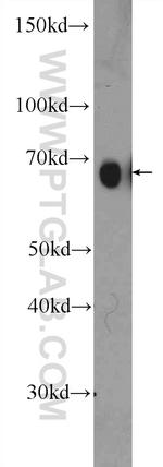 PRC1 Antibody in Western Blot (WB)