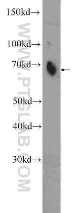 PRC1 Antibody in Western Blot (WB)