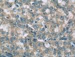 SNX6 Antibody in Immunohistochemistry (Paraffin) (IHC (P))