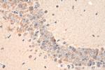 SNX6 Antibody in Immunohistochemistry (Paraffin) (IHC (P))