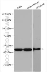 GDI2 Antibody in Western Blot (WB)