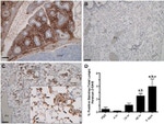 Versican V0, V1 Neo Antibody in Immunohistochemistry (IHC)