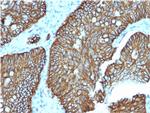 Cadherin 17/LI Cadherin (Liver-Intestine Marker) Antibody in Immunohistochemistry (Paraffin) (IHC (P))