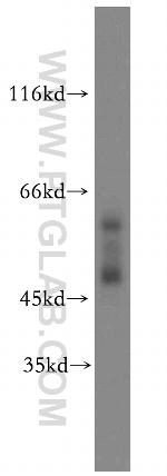 Cytokeratin 13 Antibody in Western Blot (WB)