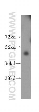 ACSM3 Antibody in Western Blot (WB)