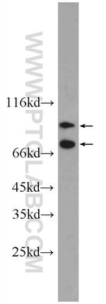 Complement factor B Antibody in Western Blot (WB)