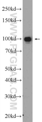 Complement factor B Antibody in Western Blot (WB)