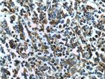 Beta Arrestin 2 Antibody in Immunohistochemistry (Paraffin) (IHC (P))