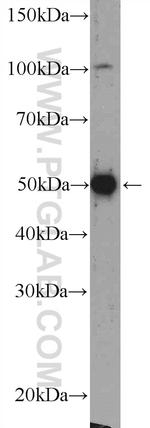 Beta Arrestin 2 Antibody in Western Blot (WB)