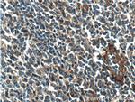 Beta Arrestin 2 Antibody in Immunohistochemistry (Paraffin) (IHC (P))