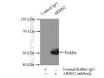 Beta Arrestin 2 Antibody in Immunoprecipitation (IP)