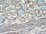 TGFBI / BIGH3 Antibody in Immunohistochemistry (Paraffin) (IHC (P))