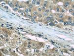 TGFBI / BIGH3 Antibody in Immunohistochemistry (Paraffin) (IHC (P))