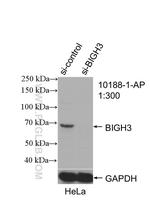 TGFBI / BIGH3 Antibody in Western Blot (WB)