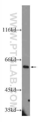 TGFBI / BIGH3 Antibody in Western Blot (WB)