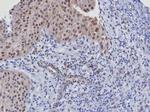 CDK4 Antibody in Immunohistochemistry (Paraffin) (IHC (P))