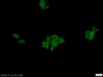 DFF45/DFFA Antibody in Immunocytochemistry (ICC/IF)