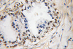 DFF45/DFFA Antibody in Immunohistochemistry (Paraffin) (IHC (P))