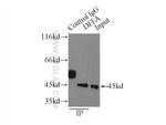 DFF45/DFFA Antibody in Immunoprecipitation (IP)