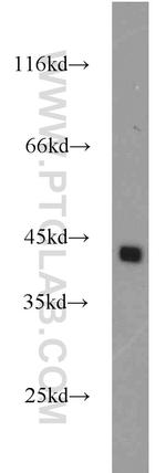 DFF45/DFFA Antibody in Western Blot (WB)