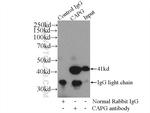 CAPG Antibody in Immunoprecipitation (IP)