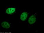 RUVBL2 Antibody in Immunocytochemistry (ICC/IF)