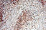 RUVBL2 Antibody in Immunohistochemistry (Paraffin) (IHC (P))